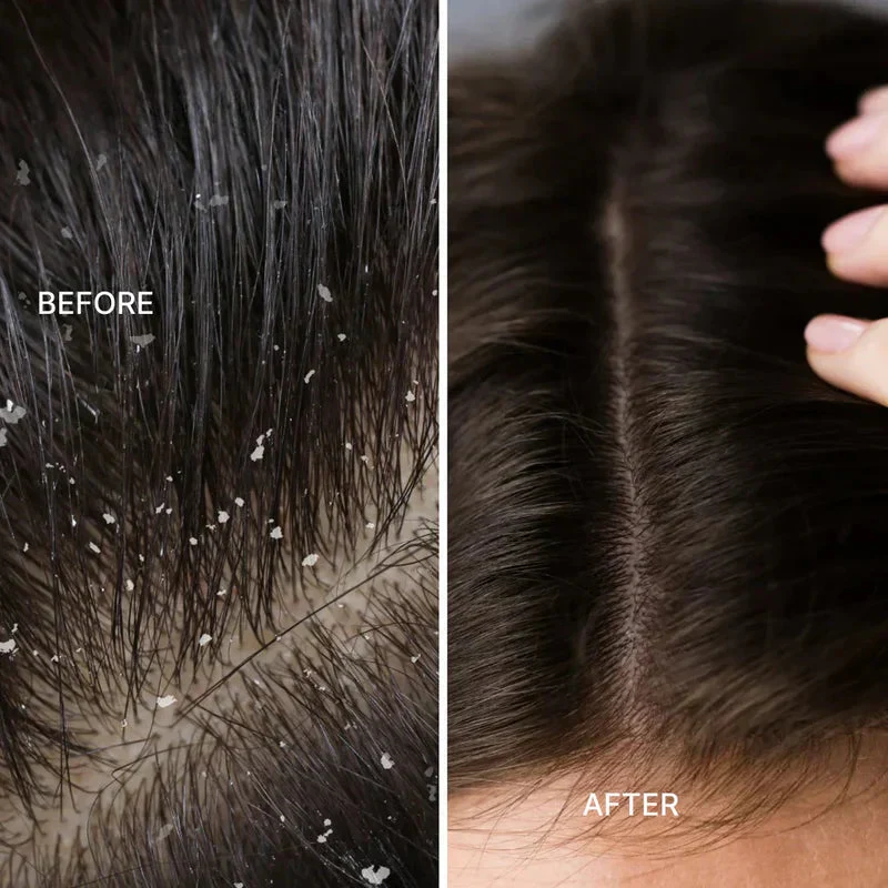 What Clearing the Scalp Actually Does