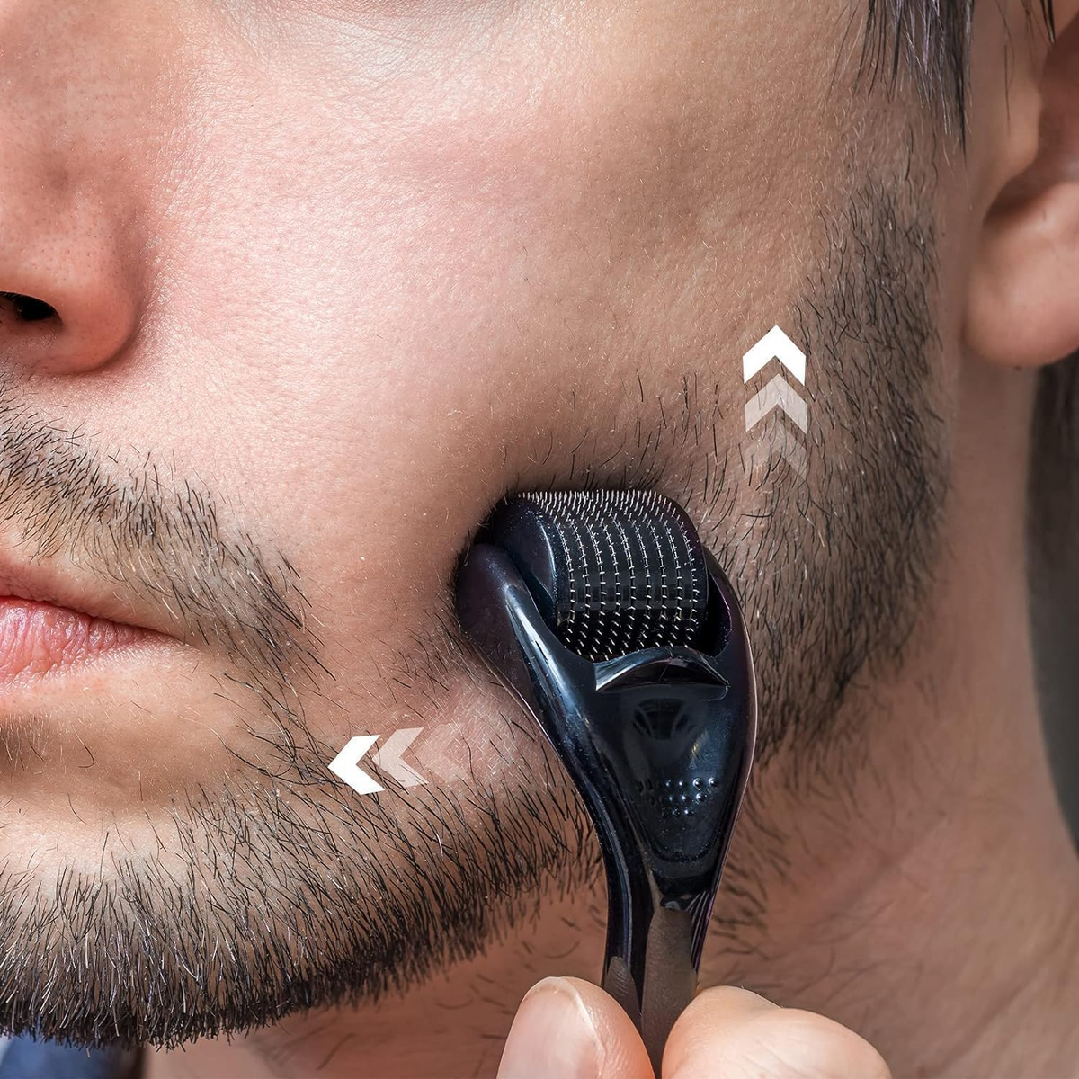 GX Activate — Titanium Derma Roller